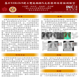 基於YOLOv9建立雙能胸腔X光影像肺結節檢測模型